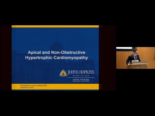 Non-obstructive Apical Variant HCM