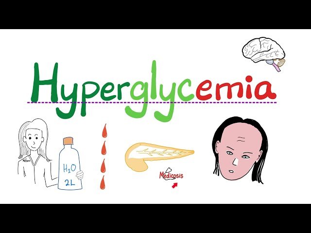 High Blood Sugar (Hyperglycemia) - Diabetes Mellitus - Endocrinology