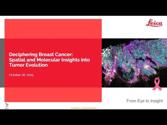 Deciphering Breast Cancer - Spatial and Molecular Insights into Tumor Evolution 2