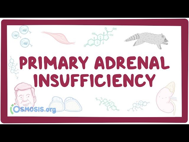 Primary Adrenal Insufficiency - Pathology, Symptoms, Diagnosis, Treatment