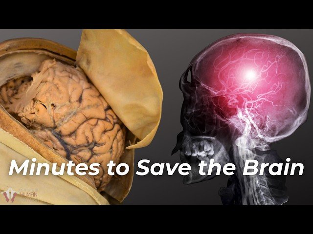 This Is What a Stroke Does to Your Brain - In Minutes