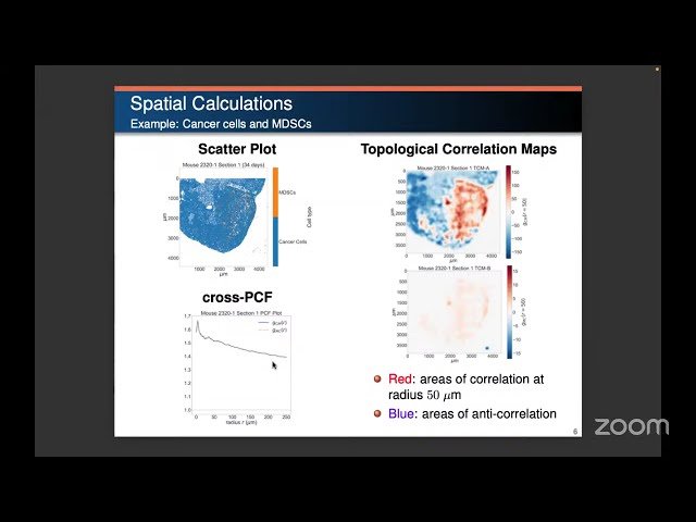Modeling Tumor-Immune Interactions in the Glioblastoma Microenvironment