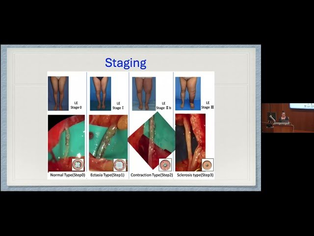 Novel Techniques for Prevention and Management of Cancer-Related Lymphedema